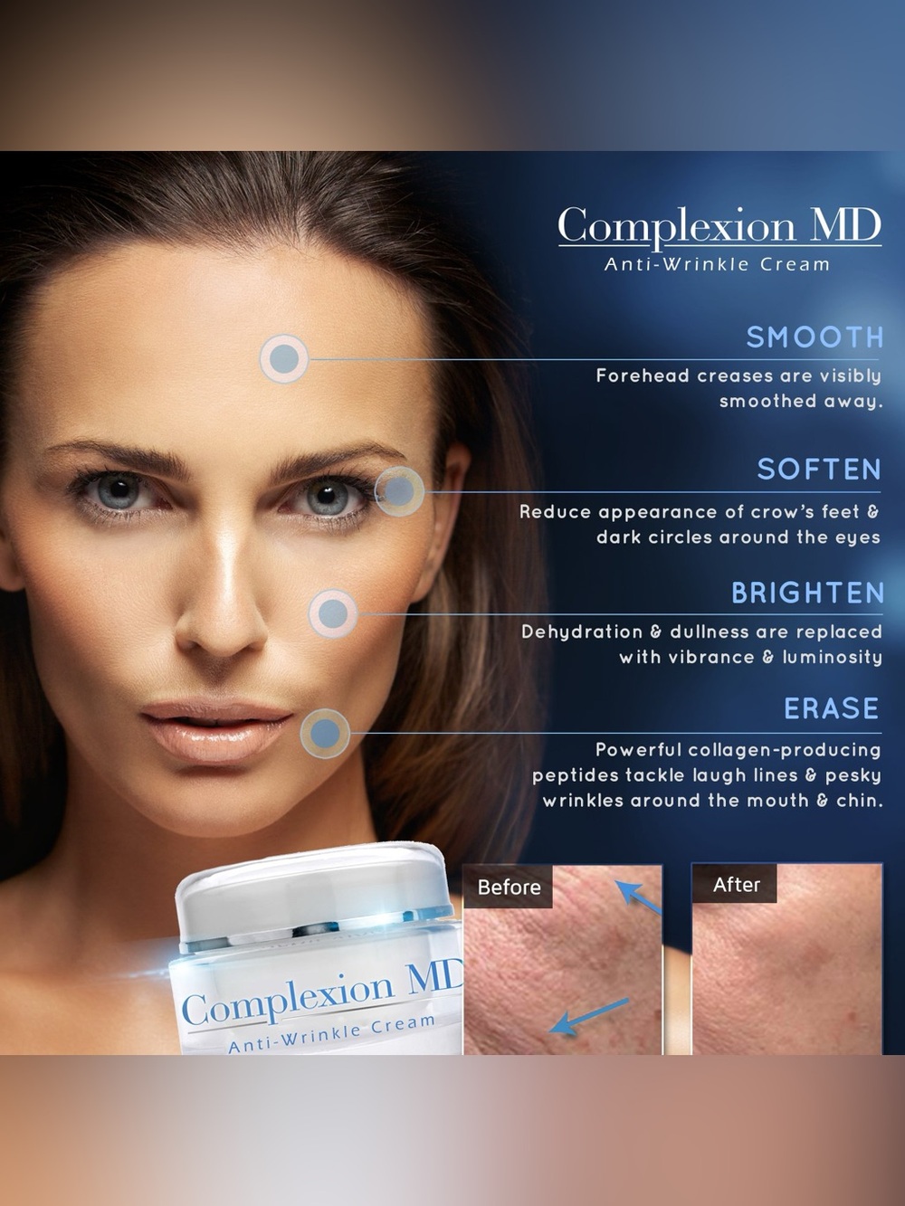 Anti-Wrinkle - complexion MD - Picture 5 of 5